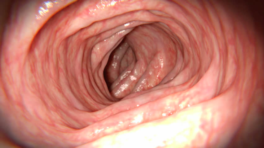 OS Benefit With Ribociclib Seen Across HR+/HER2- Breast Cancer Settings 1