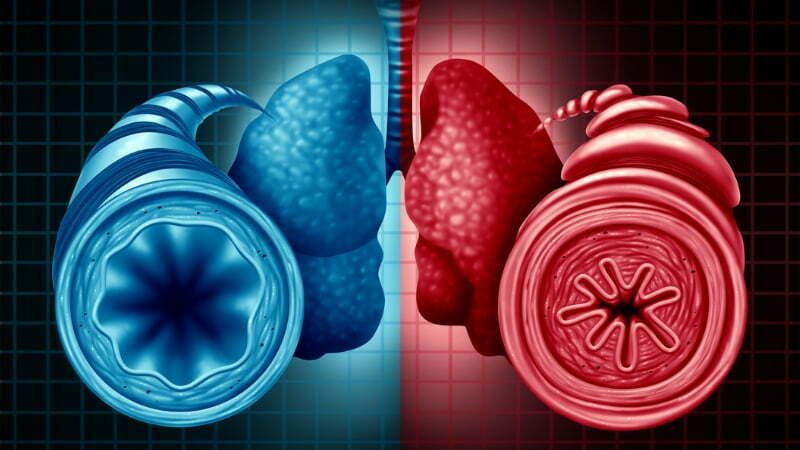 Health Insurance For Asthma Patients: A Quick Look