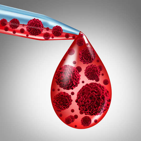 AACR pronounces new journal, Blood Cancer Discovery