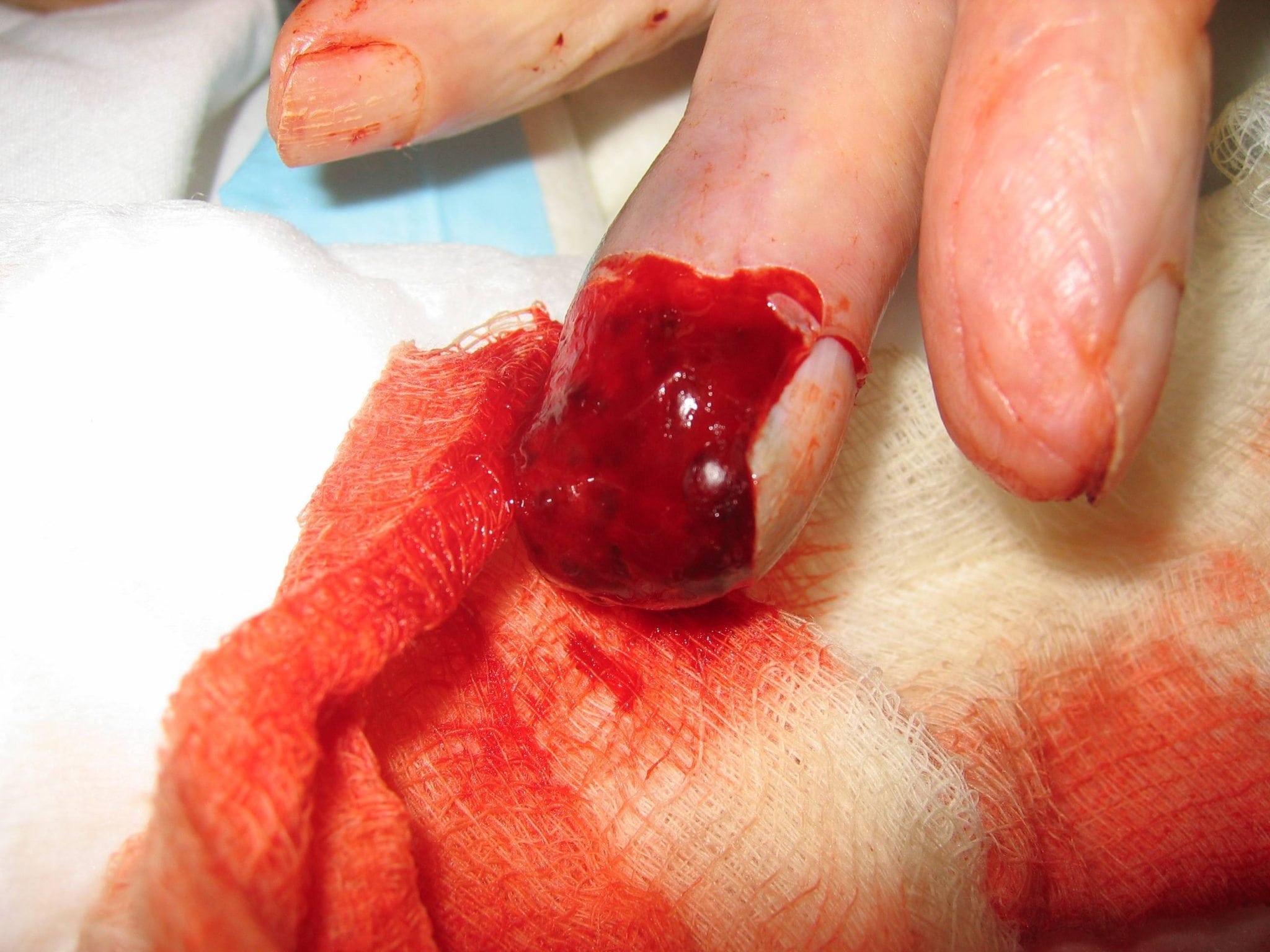 Yankees’ Edwin Encarnacion hits IL in some other injury mishap