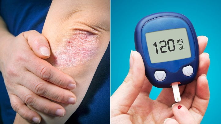 Type 2 diabetes: The excellent drink to decrease blood sugar – don’t keep away from it