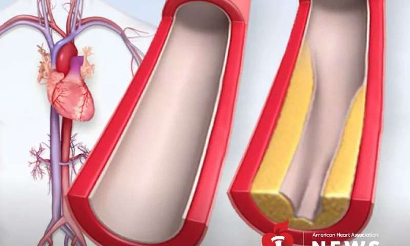 Reduce ”unsightly cholesterol” for stroke prevention