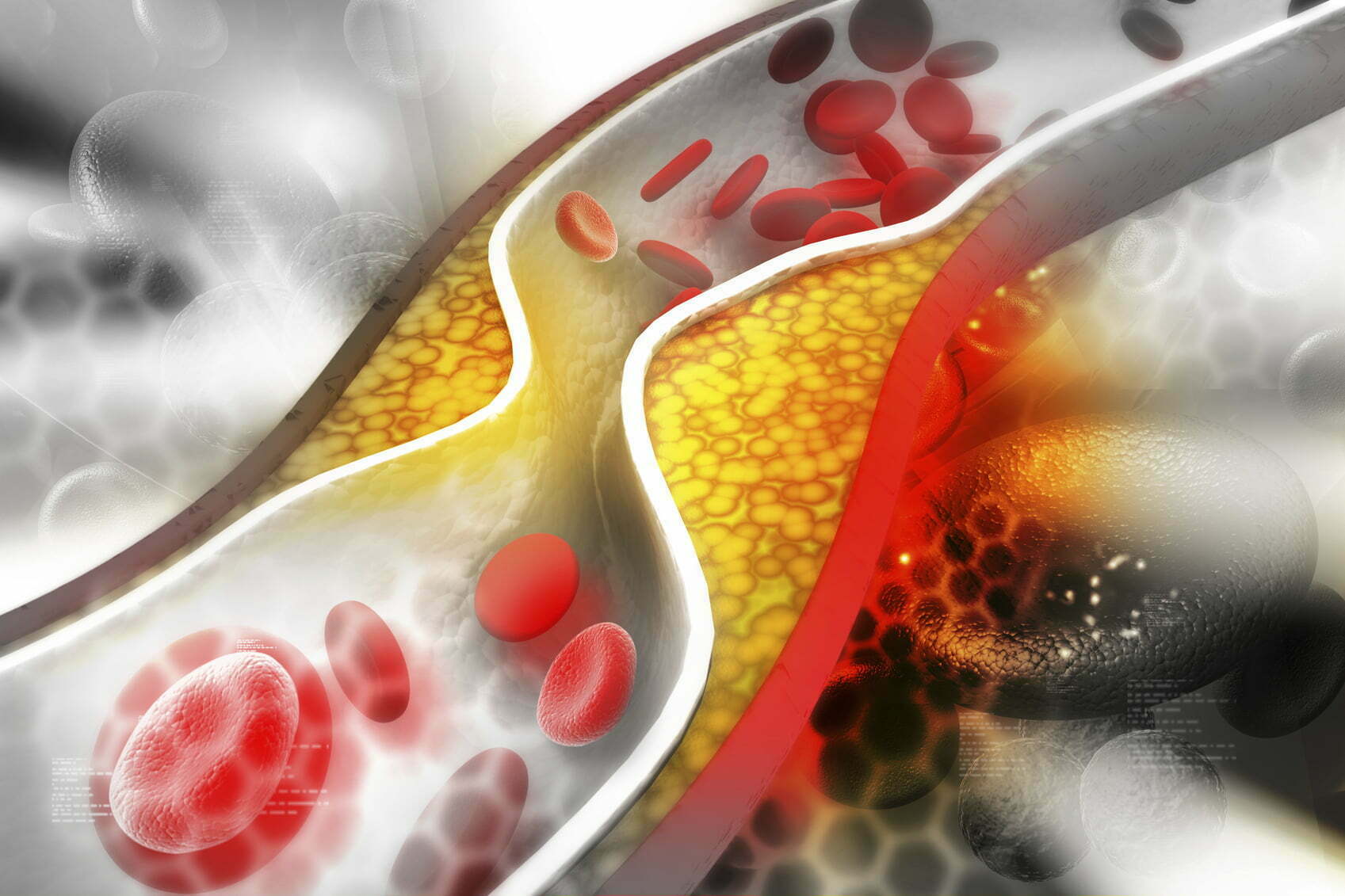 Levels of ‘unpleasant ldl cholesterol’ inside the blood are a lot better than previously imagined