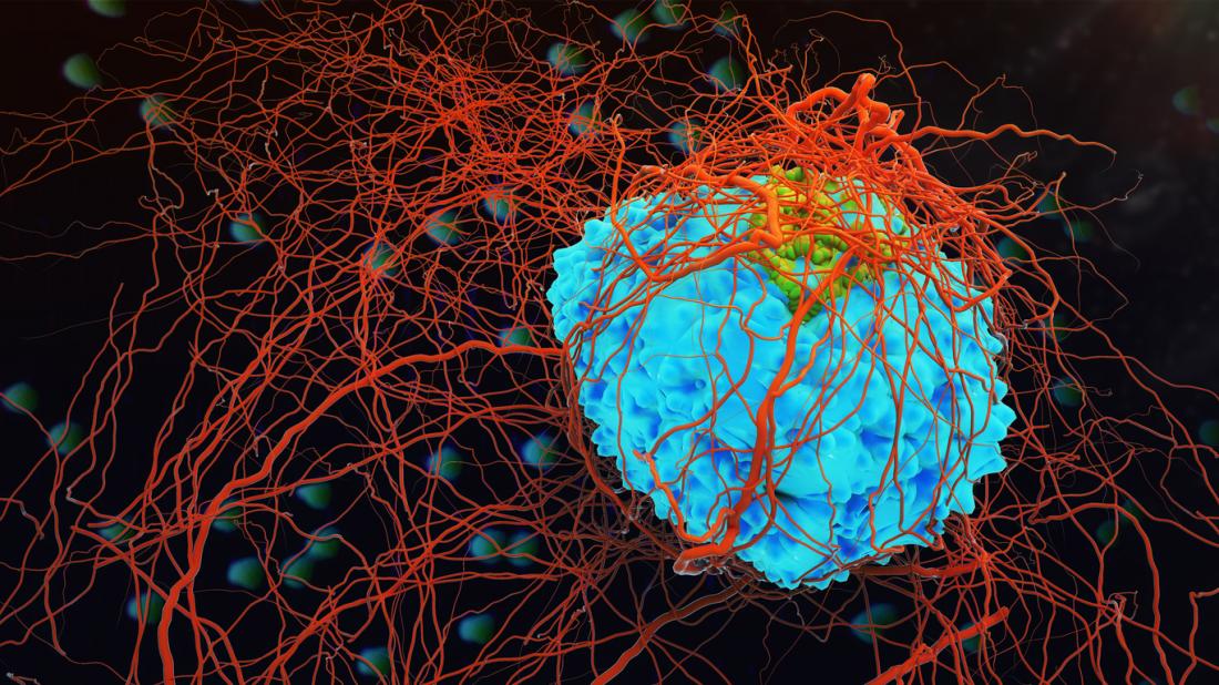 FDA approves Keytruda as treatment for specific kind of esophageal cancer 1