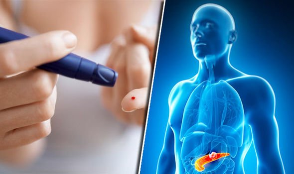 Type 2 diabetes: Five not unusual myths debunked