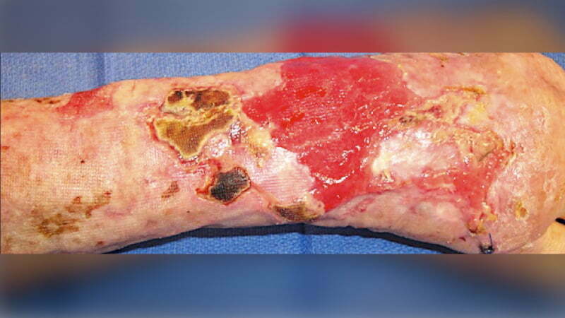 Gophers quarterback Zack Annexstad out indefinitely with foot damage