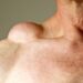 How to Get Rid Of Lumps and Bumps Naturally