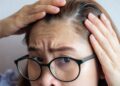 How to Address Your Hair Loss and Boost Your Confidence