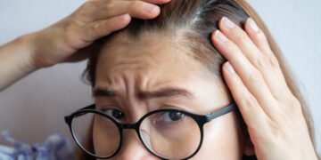 How to Address Your Hair Loss and Boost Your Confidence